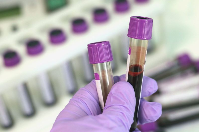Blood filter for medical analysis laboratory equipment